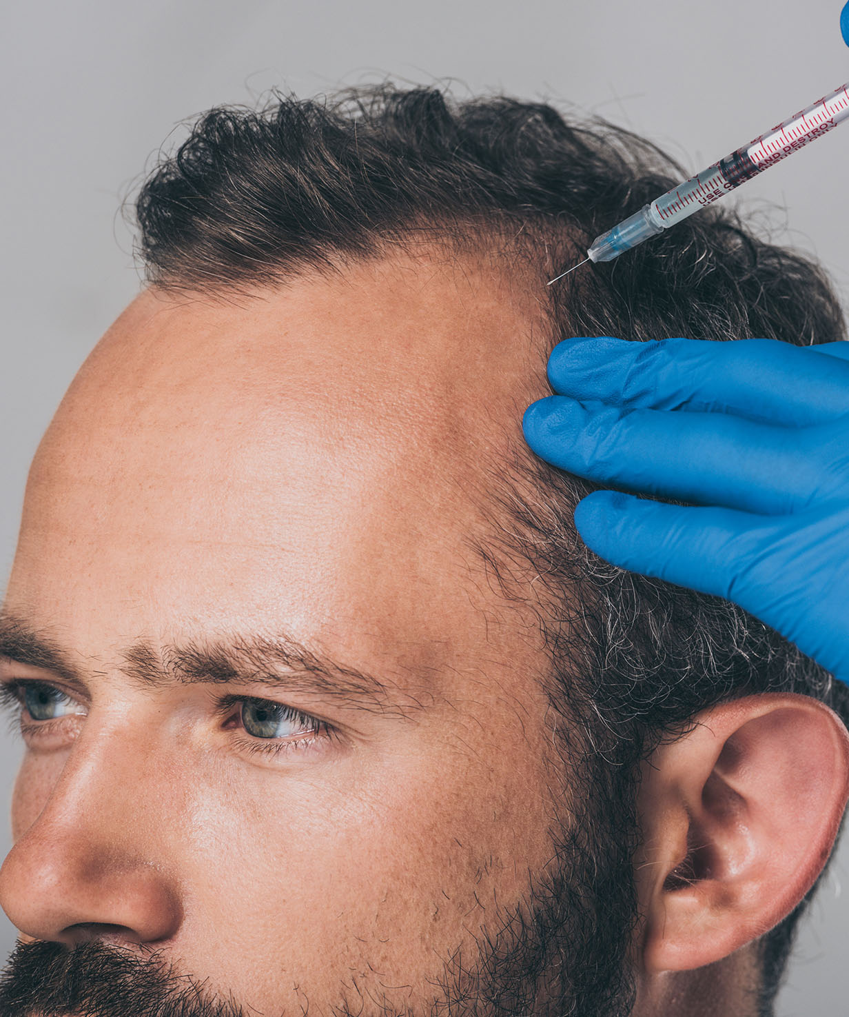 Mesotherapy banner