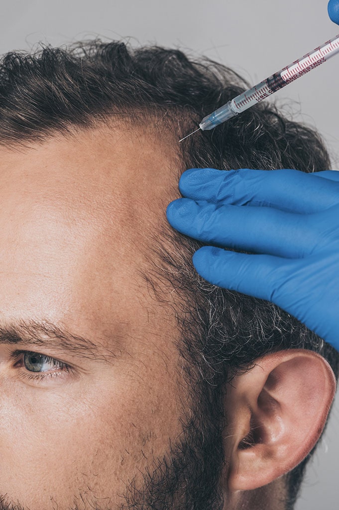 Mesotherapy