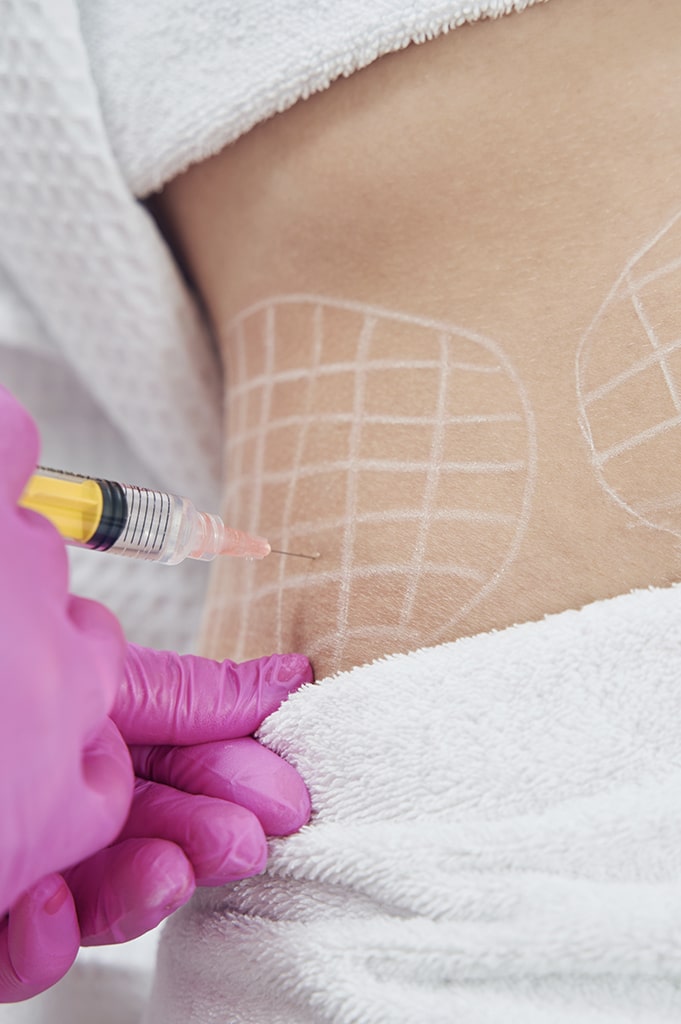 aqualyx fat dissolving injections fea