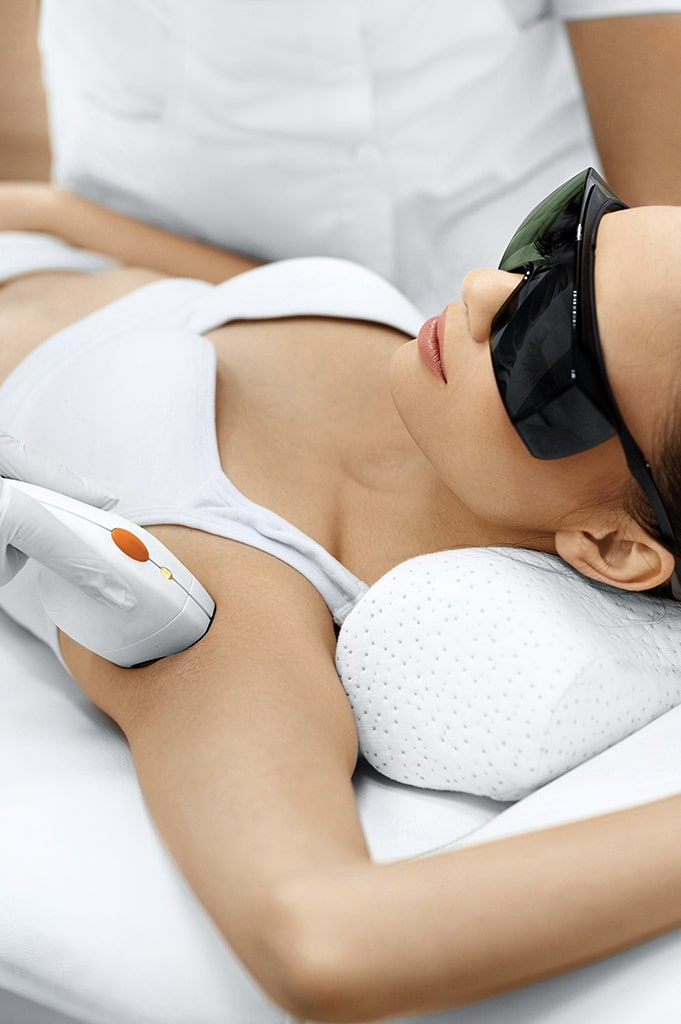 laser hair removal