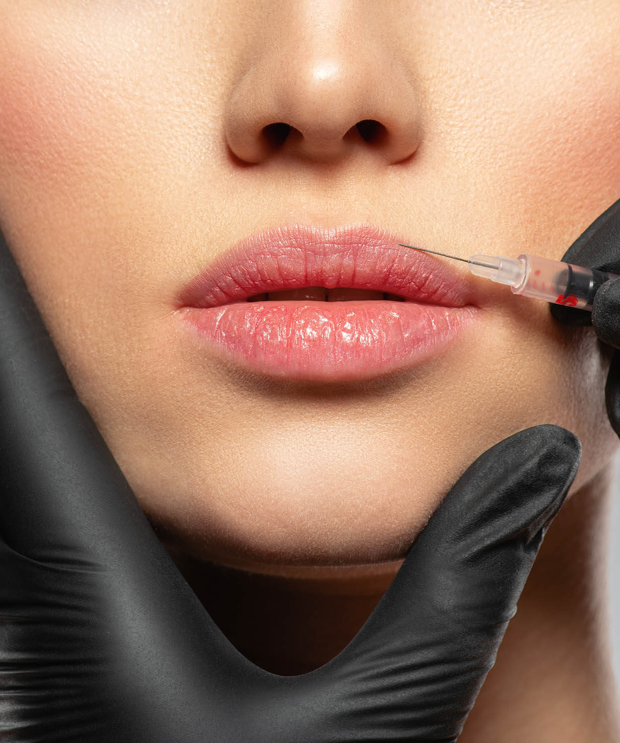 lip filler banner